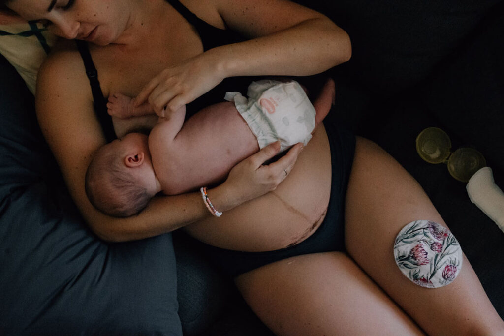 woman breastfeeding after c-section