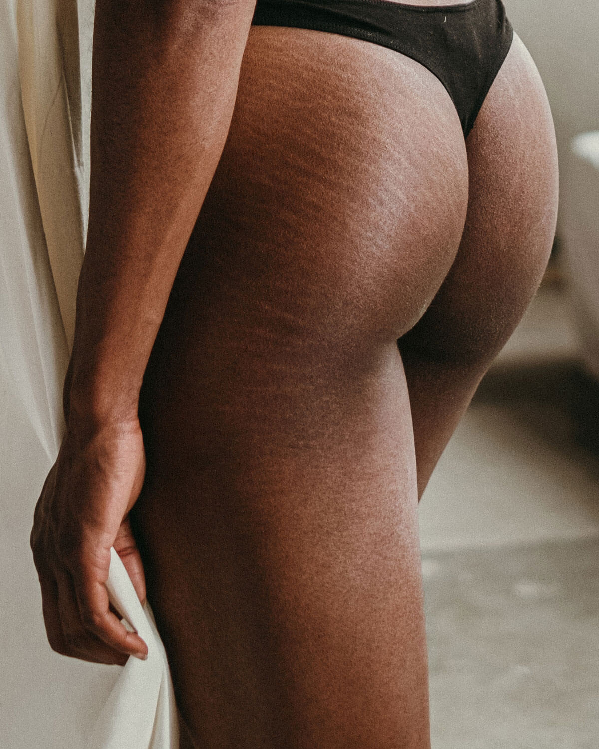 The Truth About Stretch Marks Cake Maternity photo